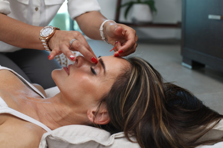 acupuncture being performed